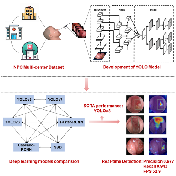 捆绑调教
李健教授团队一项鼻咽癌人工智能识别研究成果在《iScience》上发表