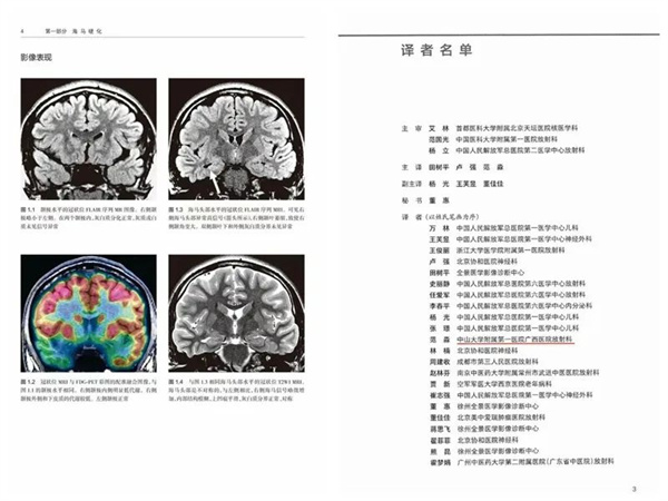 捆绑调教
放射影像科牵头完成首部主译著作——《癫痫影像病理图解》